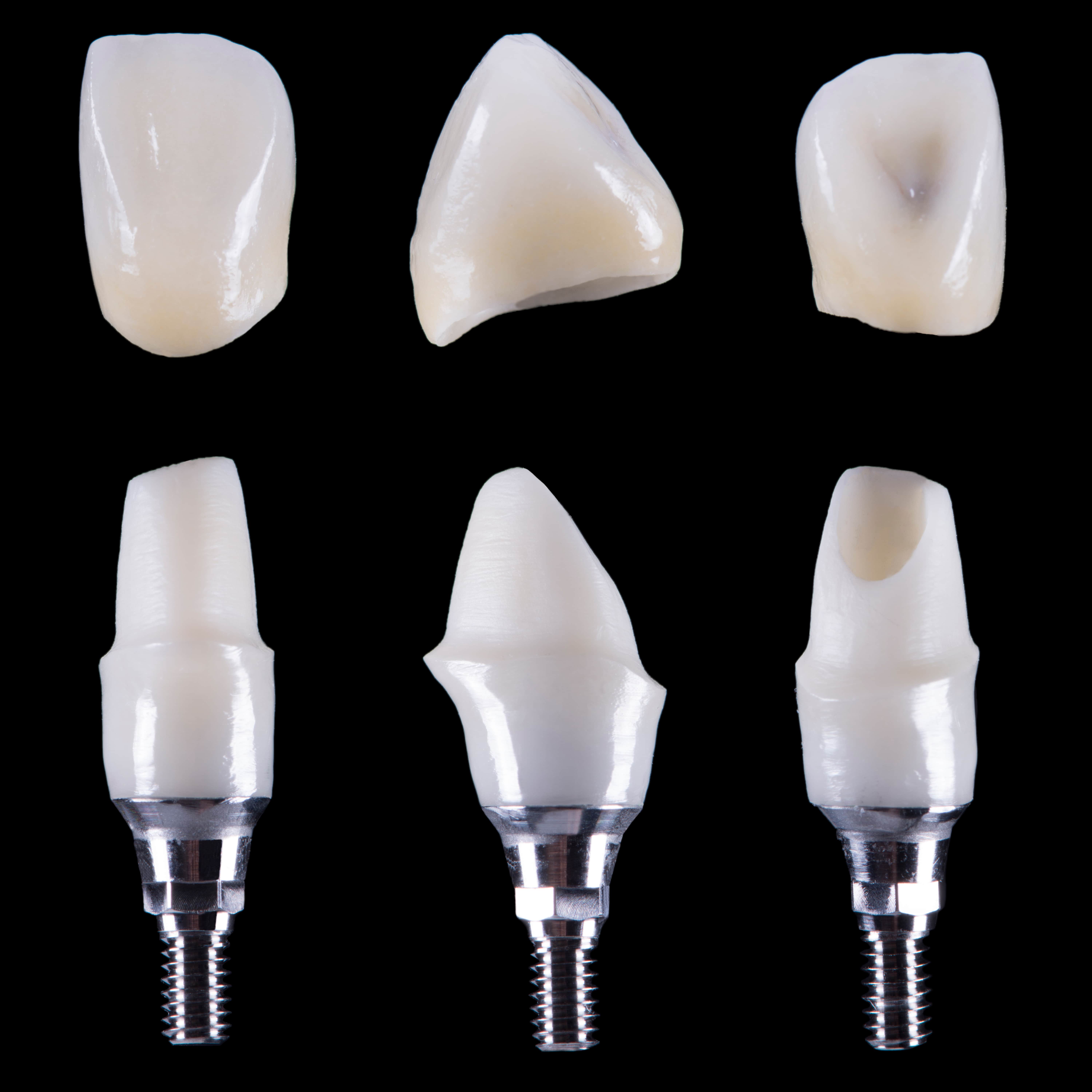 
        Zirkonyum diş restorasyonları