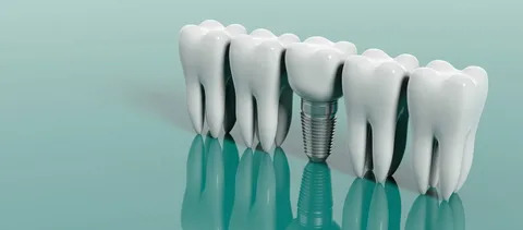 Diş Sağlığı Neden Önemlidir?