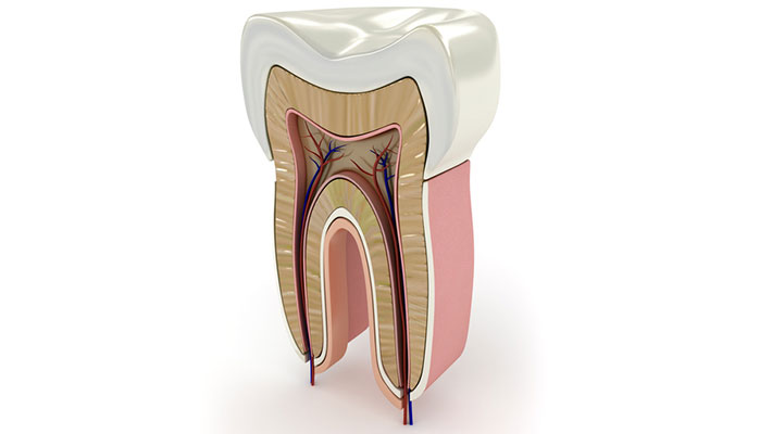 علاج جذور الاسنان (علاج القناة)